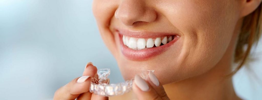 Invisalign & Your Life